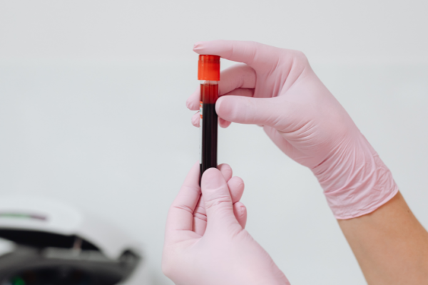 Vitamin D Testing Market Size & Growth Trends – 2035