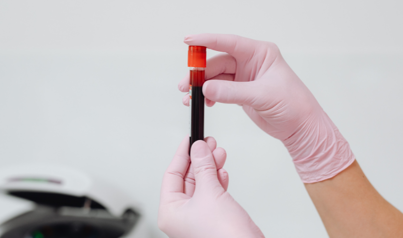 Vitamin D Testing Market